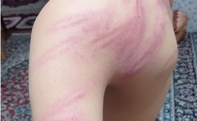 برکناری مدیر دبستان کرجو سنندج/ معرفی معلم به پزشک